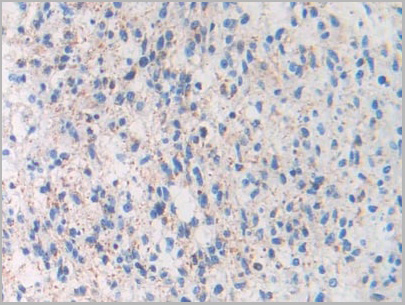 product-image-AAA21183_IHC4.jpg