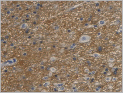 product-image-AAA21184_IHC2.jpg