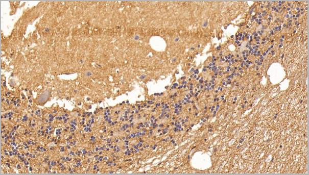 product-image-AAA21184_IHC3.jpg