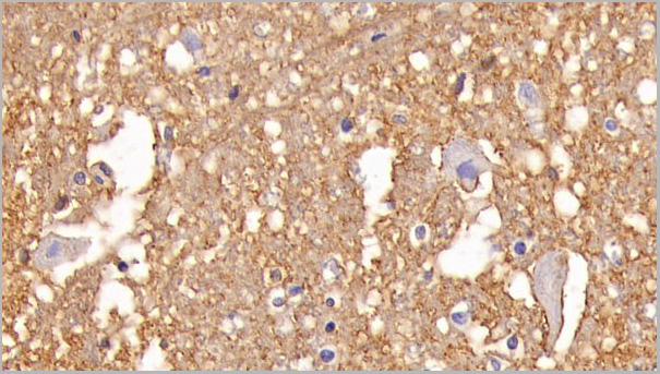 product-image-AAA21184_IHC4.jpg