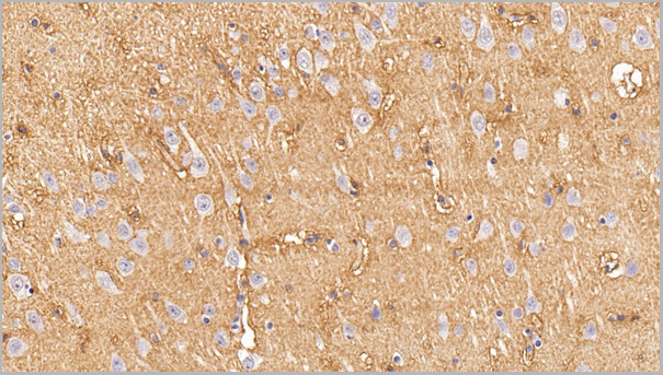 product-image-AAA21184_IHC5.jpg