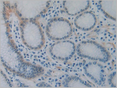 product-image-AAA21186_IHC2.jpg