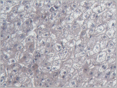 product-image-AAA21186_IHC5.jpg