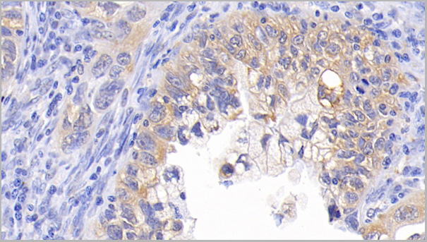 product-image-AAA21187_IHC2.jpg