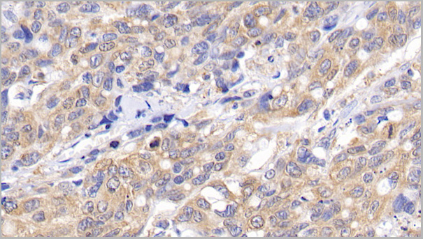 product-image-AAA21187_IHC3.jpg