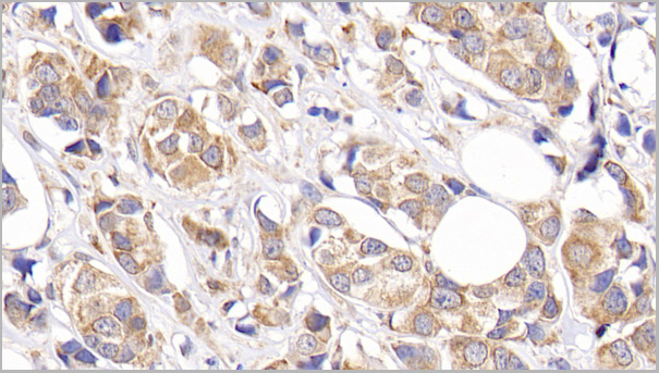 product-image-AAA21187_IHC5.jpg