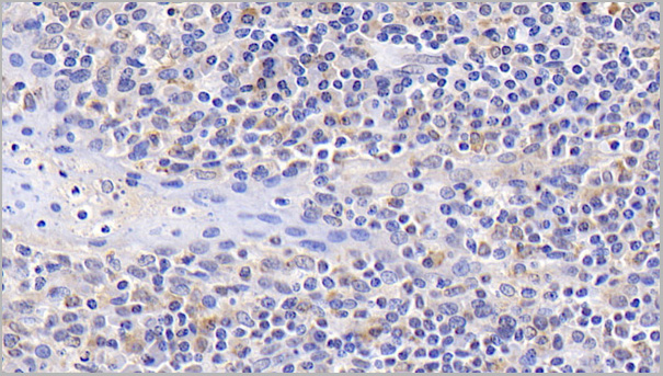 product-image-AAA21187_IHC6.jpg