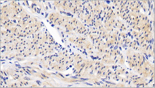 product-image-AAA21188_IHC2.jpg