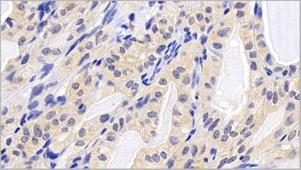 product-image-AAA21188_IHC3.jpg