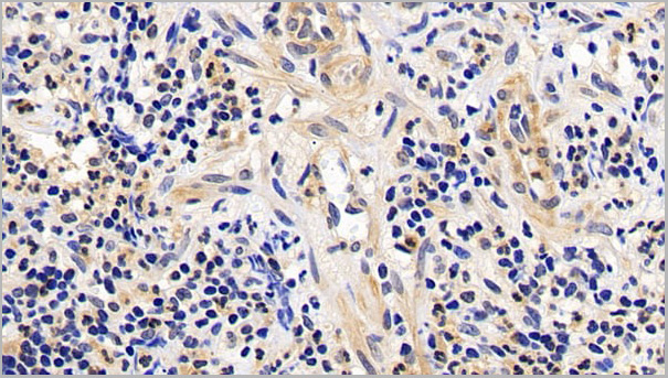 product-image-AAA21188_IHC4.jpg
