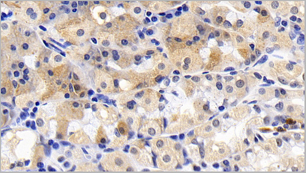 product-image-AAA21188_IHC6.jpg