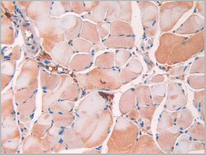 product-image-AAA21189_IHC3.jpg