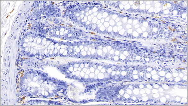 product-image-AAA21190_IHC3.jpg