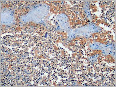 product-image-AAA21191_IHC.jpg