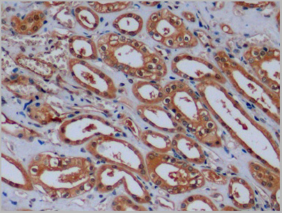 product-image-AAA21191_IHC2.jpg