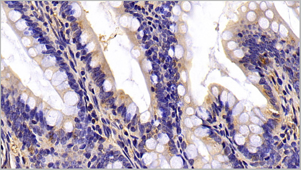product-image-AAA21191_IHC3.jpg
