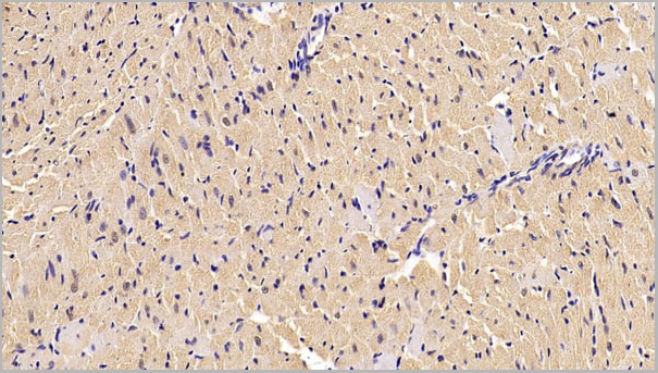 product-image-AAA21191_IHC4.jpg