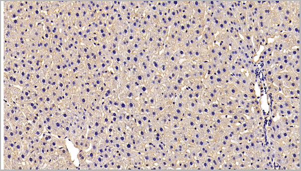 product-image-AAA21191_IHC6.jpg