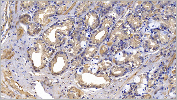 product-image-AAA21192_IHC.jpg