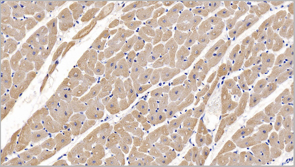 product-image-AAA21192_IHC2.jpg