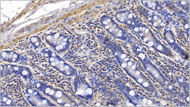 product-image-AAA21192_IHC3.jpg