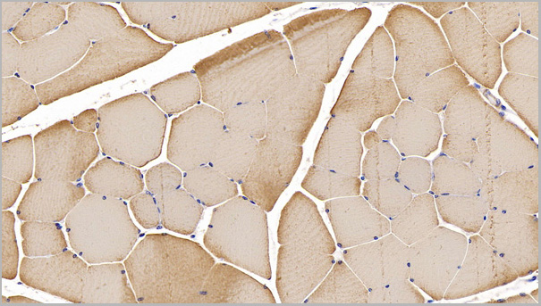 product-image-AAA21192_IHC5.jpg