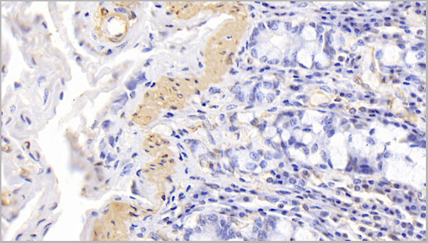 product-image-AAA21193_IHC.jpg