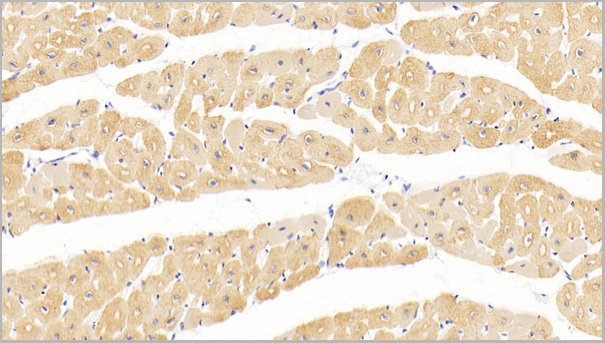 product-image-AAA21193_IHC2.jpg