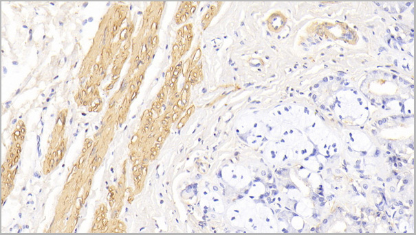 product-image-AAA21193_IHC3.jpg