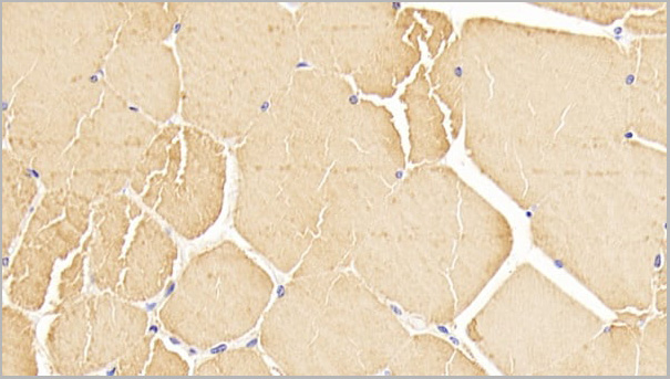 product-image-AAA21193_IHC4.jpg
