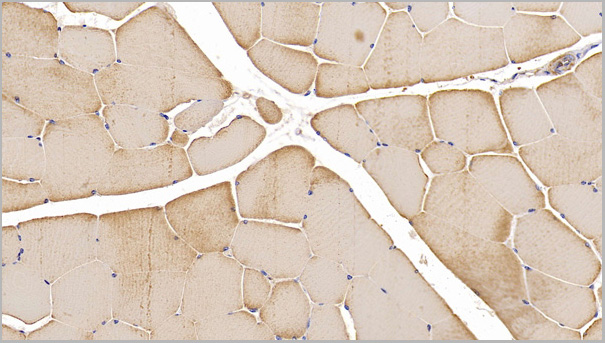 product-image-AAA21194_IHC.jpg