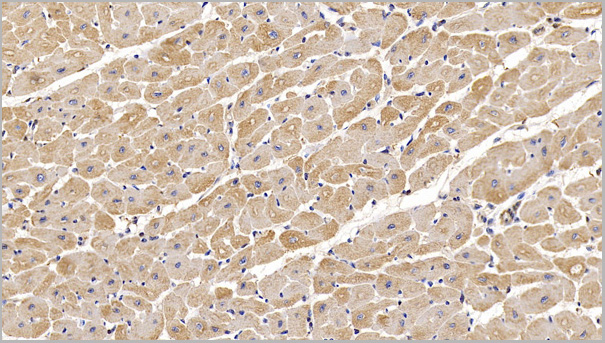 product-image-AAA21194_IHC2.jpg