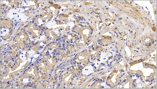 product-image-AAA21194_IHC3.jpg