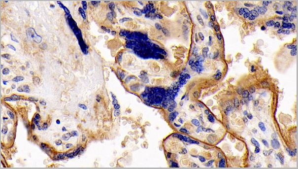 product-image-AAA21195_IHC3.jpg
