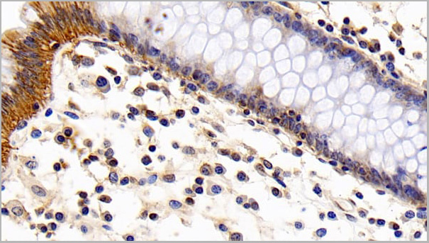 product-image-AAA21195_IHC4.jpg