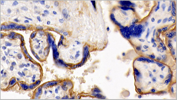 product-image-AAA21196_IHC.jpg