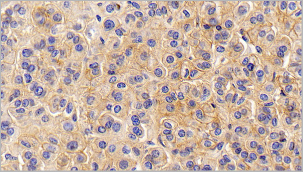 product-image-AAA21196_IHC2.jpg