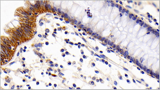 product-image-AAA21196_IHC3.jpg
