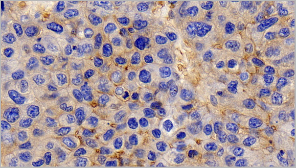 product-image-AAA21196_IHC6.jpg