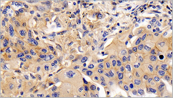 product-image-AAA21197_IHC2.jpg