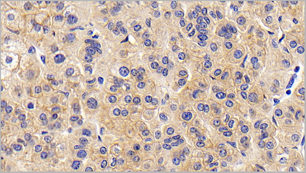 product-image-AAA21197_IHC3.jpg