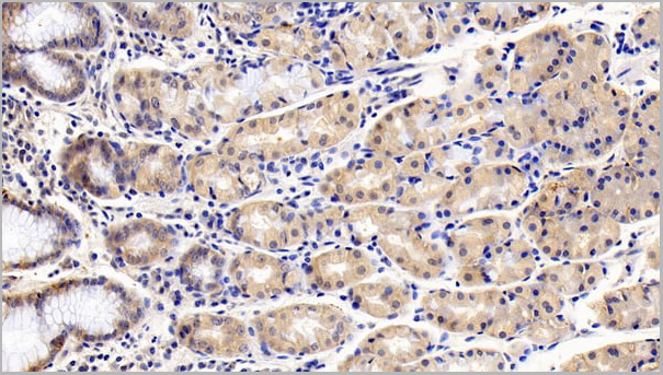 product-image-AAA21197_IHC4.jpg