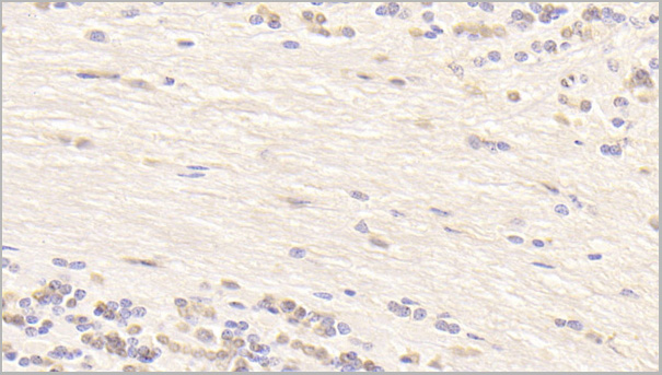 product-image-AAA21198_IHC.jpg