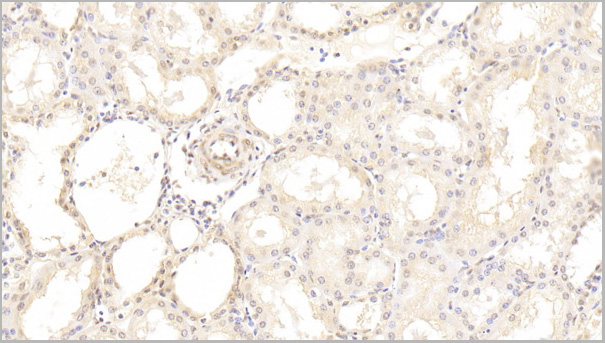 product-image-AAA21198_IHC2.jpg