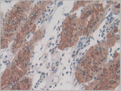 product-image-AAA21199_IHC2.jpg