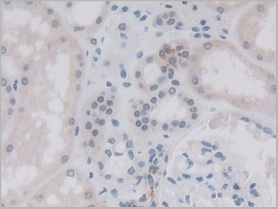 product-image-AAA21199_IHC3.jpg