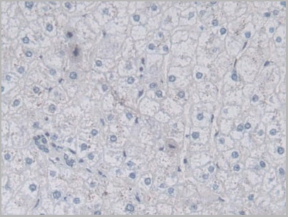 product-image-AAA21199_IHC4.jpg