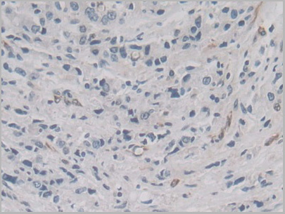 product-image-AAA21199_IHC5.jpg