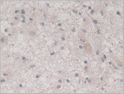 product-image-AAA21199_IHC6.jpg
