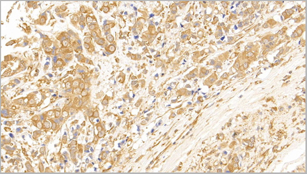 product-image-AAA21200_IHC.jpg